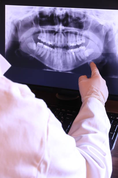 Best Broken or Chipped Tooth Repair in Parkersburg, IA