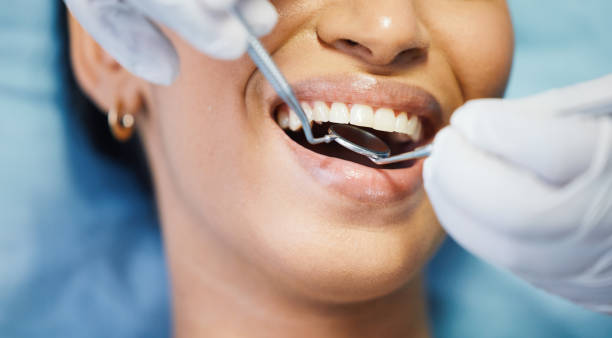 Best Emergency Denture Repair in Parkersburg, IA